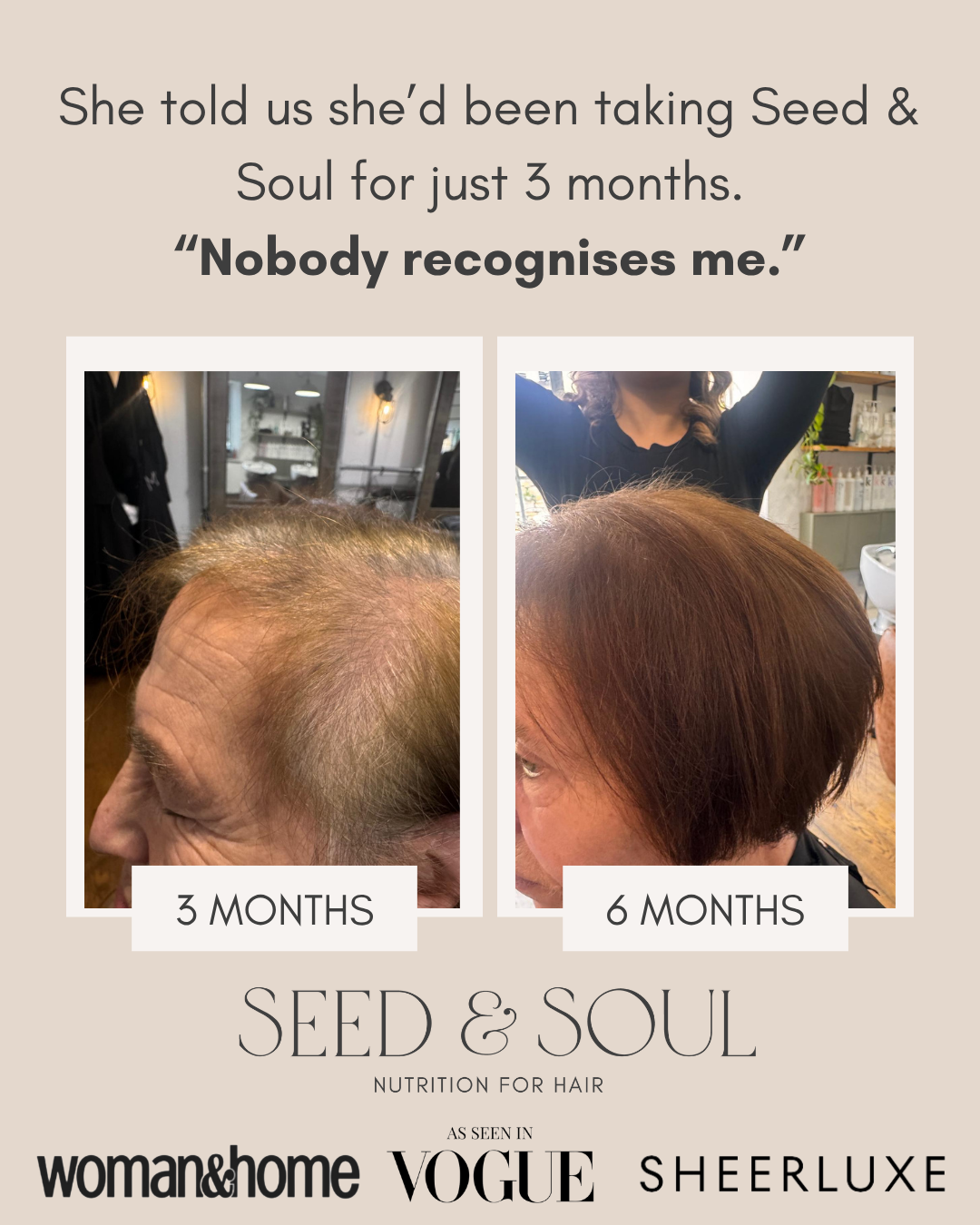Hair Health Starter Bundle